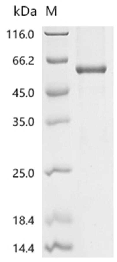 Androgen receptor Protein, Human, Recombinant (His & Myc & SUMO)