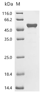 CK2 alpha/CSNK2A1 Protein, Human, Recombinant (His)