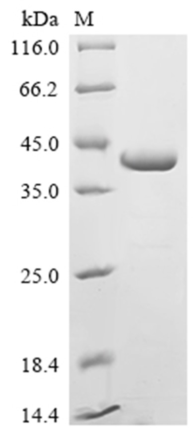 Zaire ebolavirus (strain Kikwit-95) VP35 Protein (His & Myc)