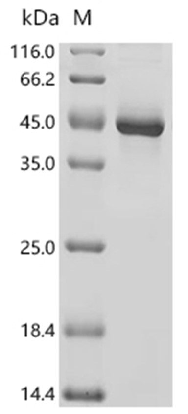MACROD1 Protein, Human, Recombinant (His)