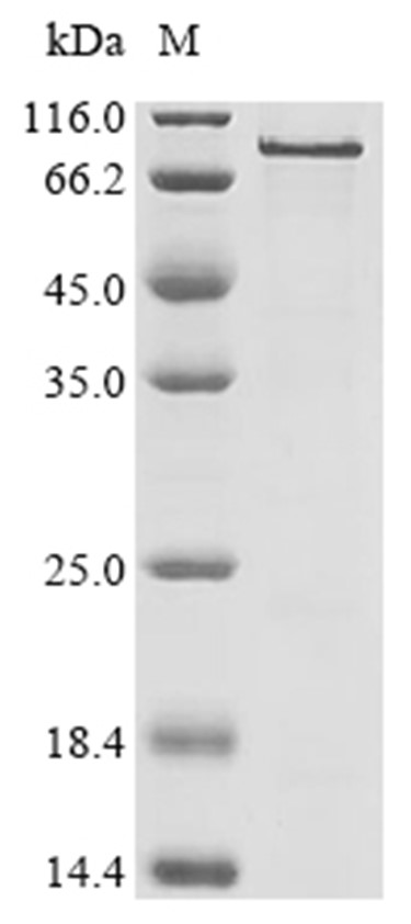 MDM2 Protein, Mouse, Recombinant (His)