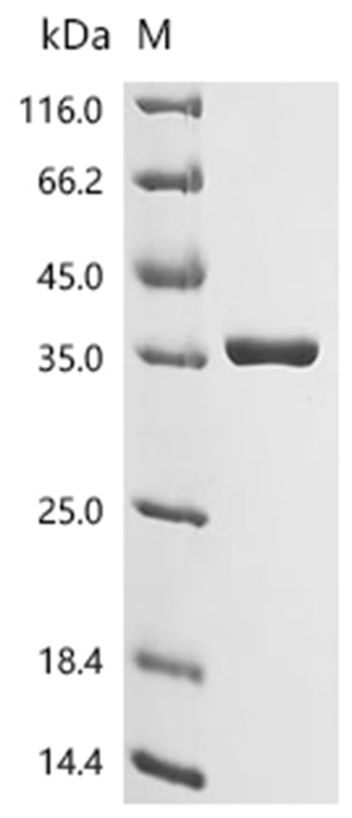HSP90AA1 Protein, Human, Recombinant (His)
