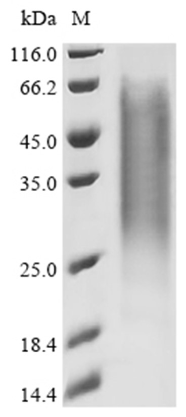 Gingipain R1 Protein, Porphyromonas gingivalis, Recombinant (His)