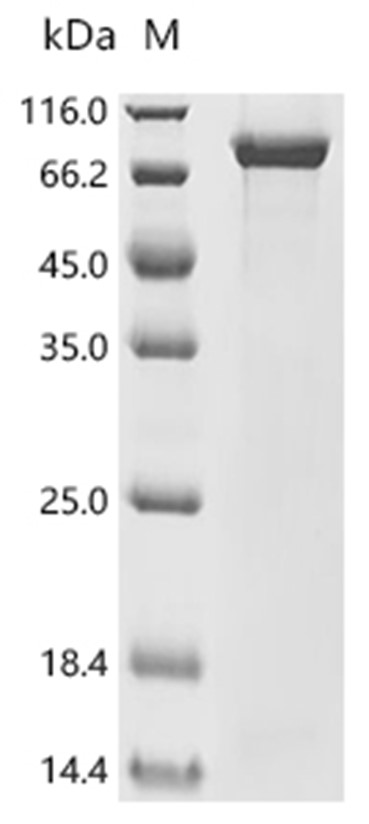 PLOD2 Protein, Mouse, Recombinant (E. coli, His & Myc)
