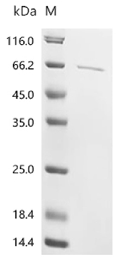 NEFH Protein, Human, Recombinant (His & Myc & SUMO)