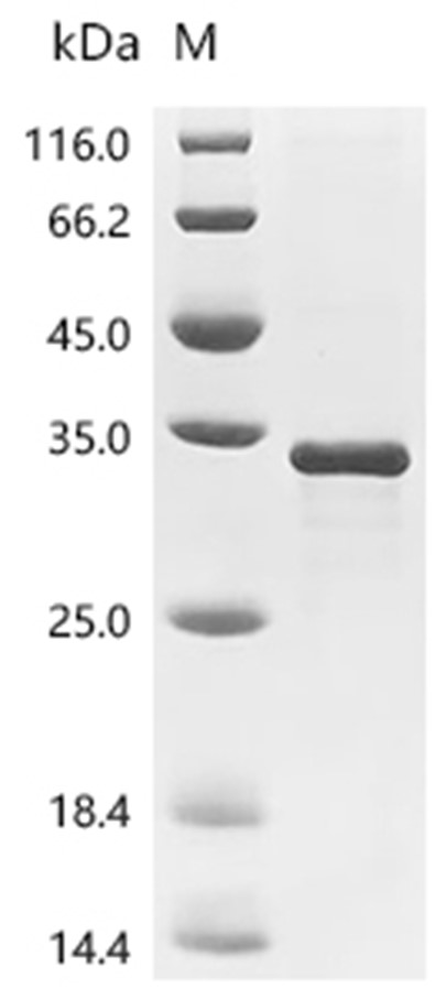 MeTAP1 Protein, Mycobacterium tuberculosis, Recombinant (His)