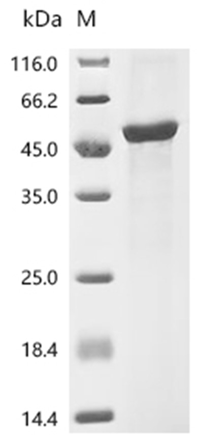 GSK3B Protein, Human, Recombinant (E. coli, His)