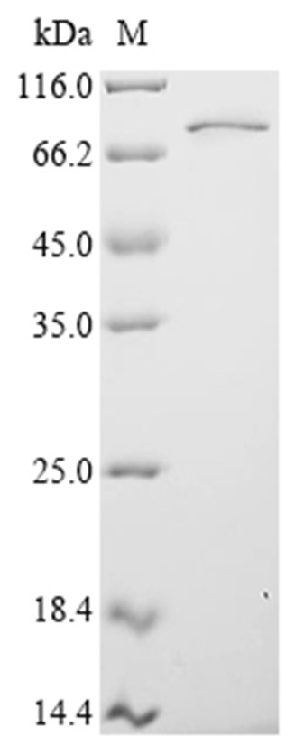 FUS Protein, Human, Recombinant (His & Myc)