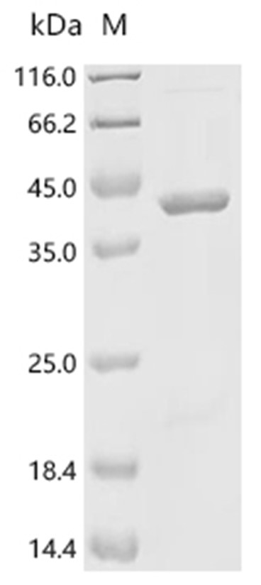 RAB5A Protein, Human, Recombinant (His & SUMO)