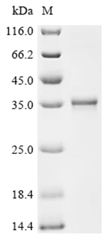 JAK1 Protein, Human, Recombinant (His)
