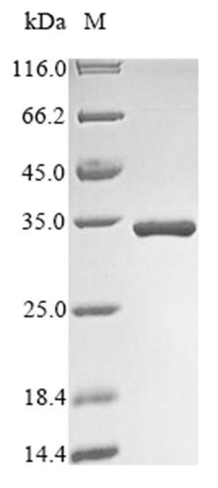 CBR1 Protein, Human, Recombinant (E. coli, His)