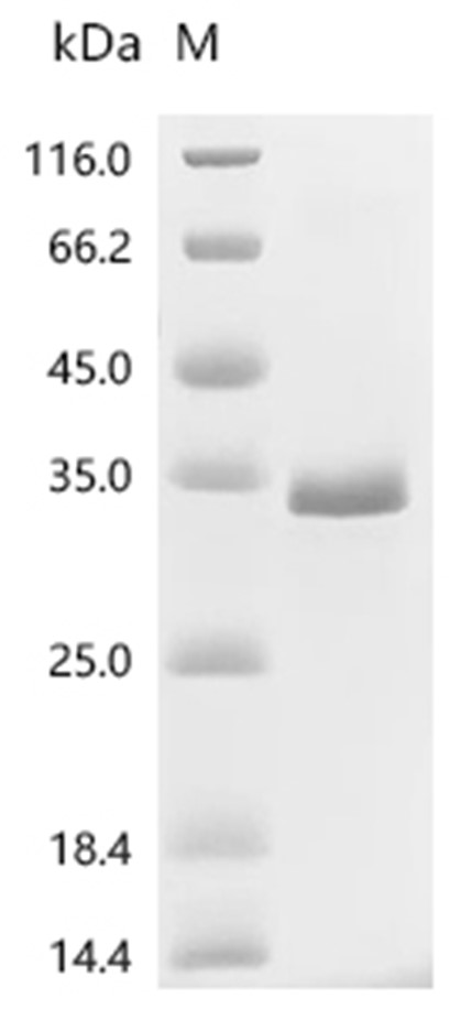 PIEZO1 Protein, Human, Recombinant (His & Myc)