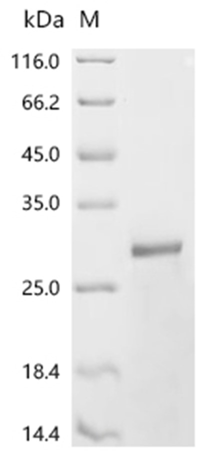 CHRM1 Protein, Human, Recombinant (His)