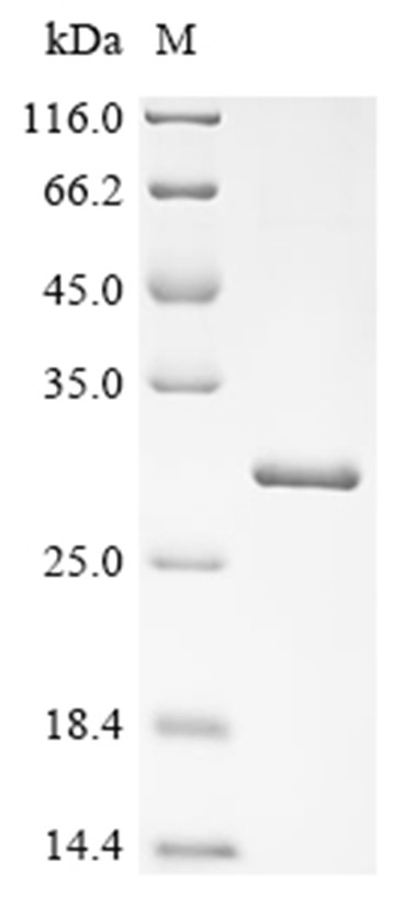 Cathepsin K Protein, Human, Recombinant (His)