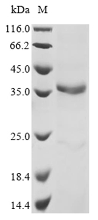ADAMDEC1 Protein, Mouse, Recombinant (His)