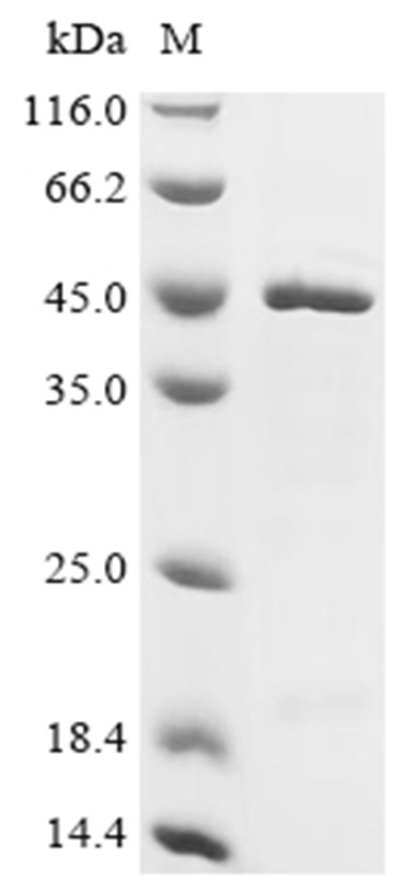 JAK2 Protein, Human, Recombinant (His)