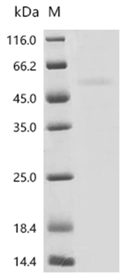 LIPA Protein, Human, Recombinant (His)