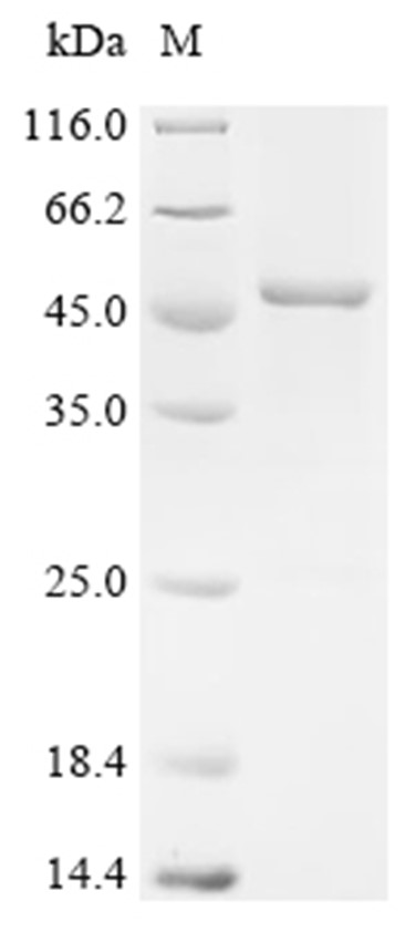 LAMA5 Protein, Human, Recombinant (His & SUMO)