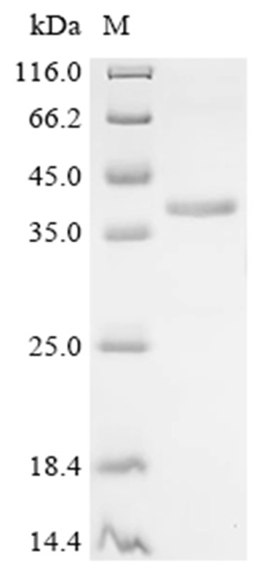 HMGCR Protein, Human, Recombinant (His)