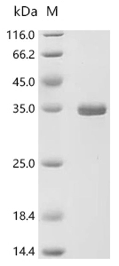 C1QA Protein, Mouse, Recombinant (E. coli, His)