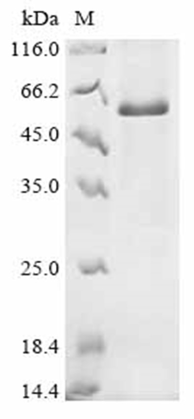 CTGF/CCN2 Protein, Mouse, Recombinant (GST)