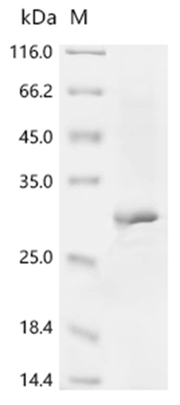 Cathepsin K Protein, Mouse, Recombinant (His)