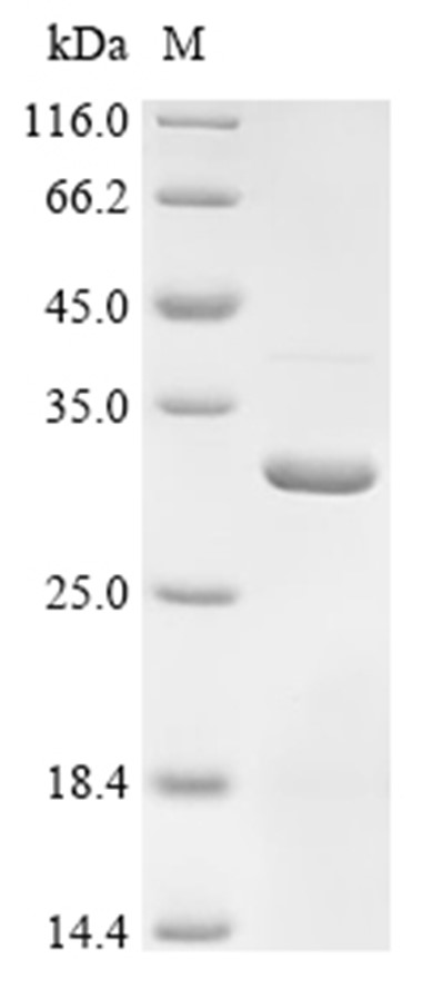 GLP1R Protein, Mouse, Recombinant (His & SUMO)