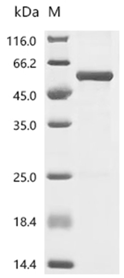 Cereblon/CRBN Protein, Human, Recombinant (Cell-Free, His)
