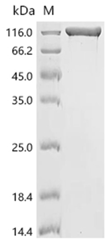 ACE2 Protein, Paguma larvata, Recombinant (hFc)