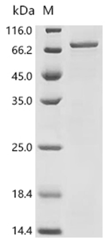 DHX9 Protein, Human, Recombinant (His & SUMO)