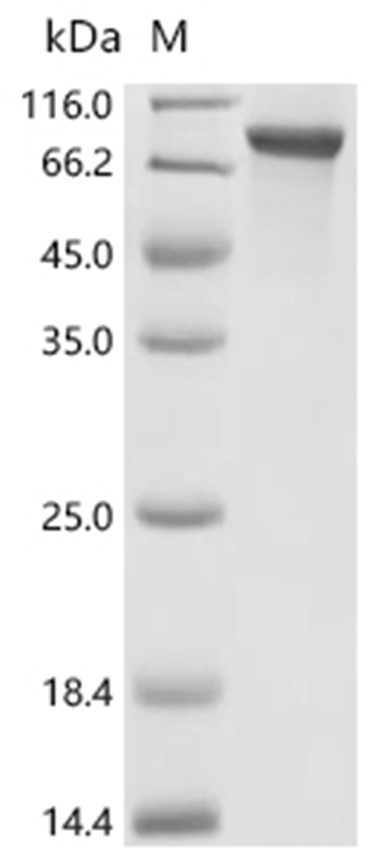 PRKCD Protein, Human, Recombinant (His)