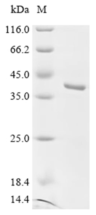 FGF-5 Protein, Human, Recombinant (His)