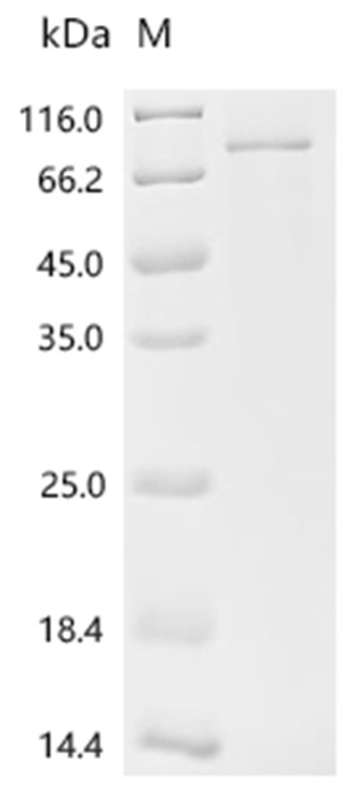 TRAF6 Protein, Human, Recombinant (His & SUMO)