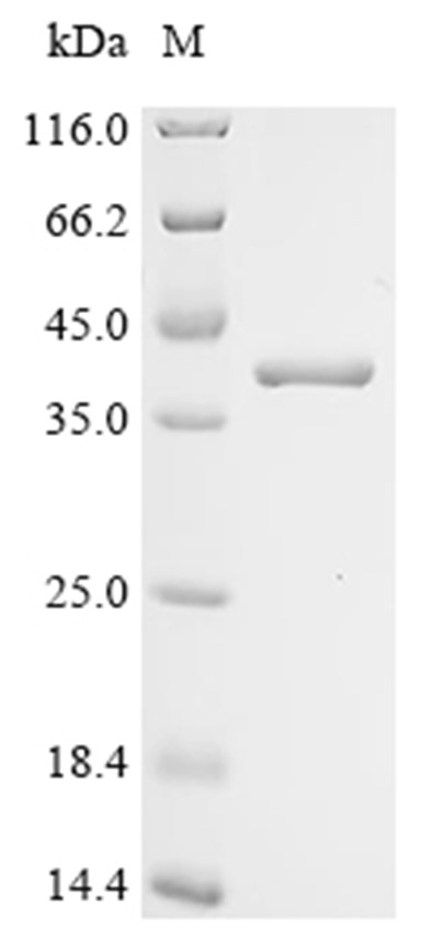 CTHRC1 Protein, Mouse, Recombinant (His & SUMO)