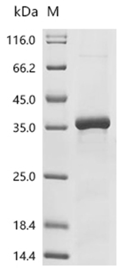 NEK9 Protein, Human, Recombinant (His)