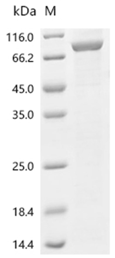 Lanosterol synthase/LSS Protein, Human, Recombinant (His)