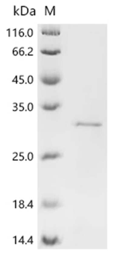 GABRA1 Protein, Human, Recombinant (His)