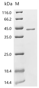 Zinc Alpha 2 Glycoprotein/AZGP1 Protein, Mouse, Recombinant (His)