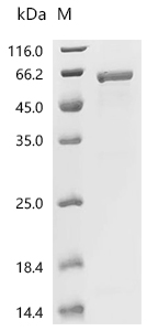 Pyridoxal kinase Protein, Human, Recombinant (GST)