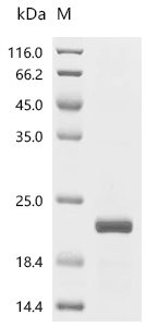 SOD1 Protein, Mouse, Recombinant (E. coli, His)
