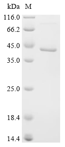 Interferon kappa/IFNK Protein, Human, Recombinant (His & SUMO)