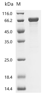 DNA photolyase Protein, Synechococcus sp., Recombinant (His & Myc & SUMO)
