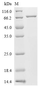 ACSS1 Protein, Human, Recombinant (His)