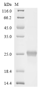 Metallothionein-4/MT4 Protein, Human, Recombinant (His & SUMO)
