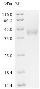TEM8/ANTXR1 Protein, Mouse, Recombinant (His & Myc)