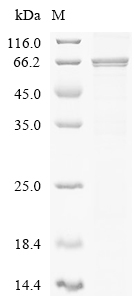 ERVK-7 Protein, Human, Recombinant (His)