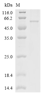 Tyrosinase/TYR Protein, Human, Recombinant (His)