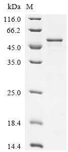 GSK3B Protein, Human, Recombinant (E. coli, His)