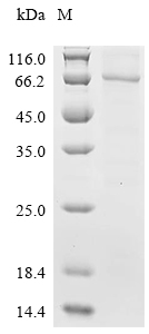 GSPT1 Protein, Human, Recombinant (His & Myc)