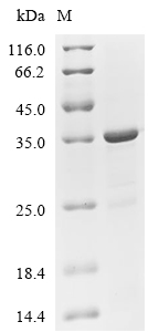 FPR2 Protein, Mouse, Recombinant (GST & His & Myc)